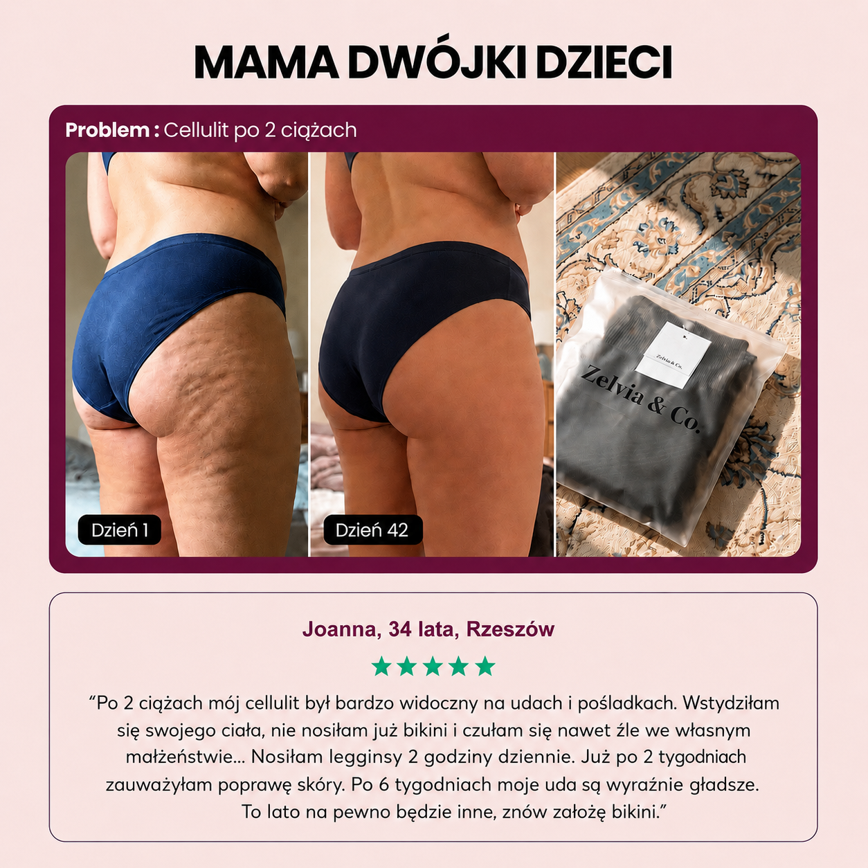 Leggings Moldeadores 3D | Push-Up + Efecto Anticelulitis