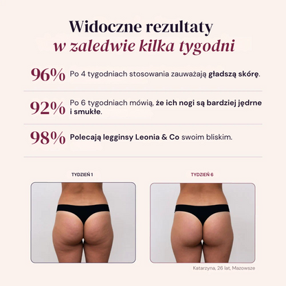 Legginsy Modelujące 3D – Push-Up & Antycellulitowe