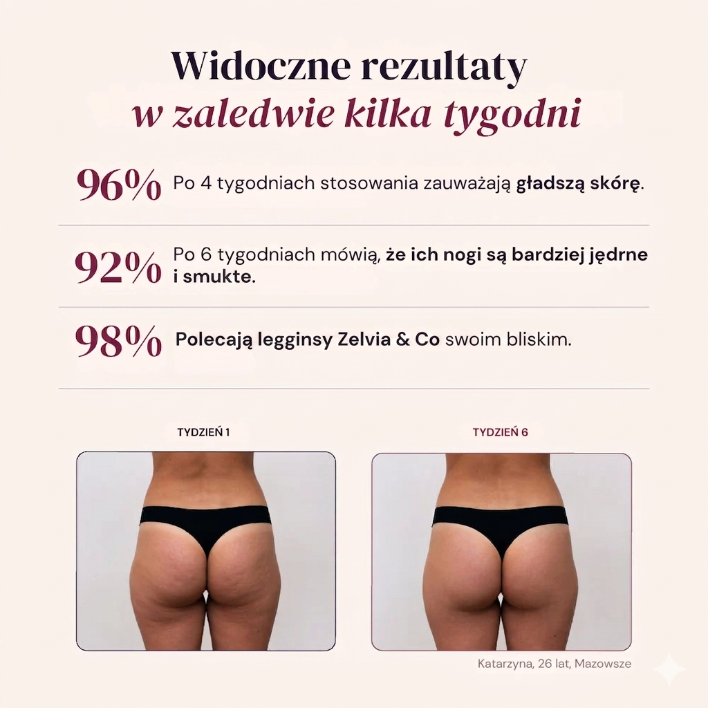 Leggings Moldeadores 3D | Push-Up + Efecto Anticelulitis