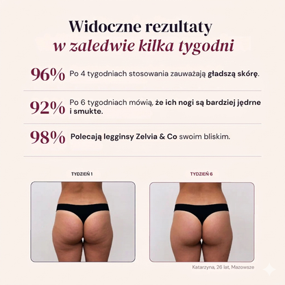 Leggings Moldeadores 3D | Push-Up + Efecto Anticelulitis